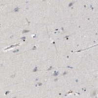Anti-OLIG3 antibody produced in rabbit 