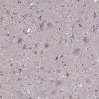 Anti-OR2W3 antibody produced in rabbit 