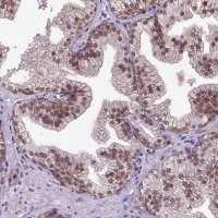 Anti-ORC5 antibody produced in rabbit 