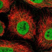 Anti-OSBPL7 antibody produced in rabbit HPA053083-100UL