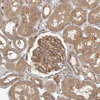 Anti-OSBPL9 antibody produced in rabbit