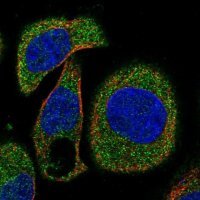 Anti-OSTF1 antibody produced in rabbit 