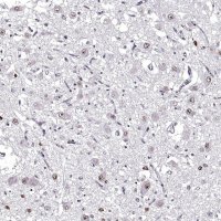 Anti-OTP antibody produced in rabbit 
