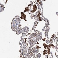 Anti-OTUD1 antibody produced in rabbit