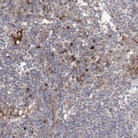 Anti-OTUD1 antibody produced in rabbit