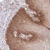 Anti-OTUD4 antibody produced in rabbit