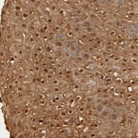Anti-OVOL1 antibody produced in rabbit 