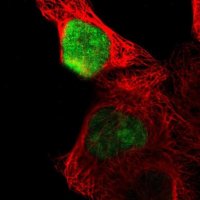 Anti-OVOL1 antibody produced in rabbit 