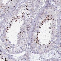 Anti-OXLD1 antibody produced in rabbit 