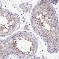Anti-P2RX3 antibody produced in rabbit 