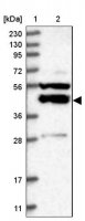 Anti-P2RY10 antibody produced in rabbit 