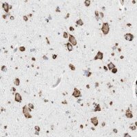 Anti-P4HTM antibody produced in rabbit HPA007199-100UL
