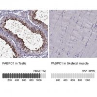 Anti-PABPC1 antibody produced in rabbit 