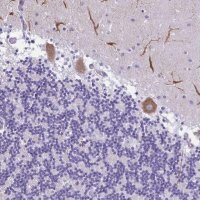 Anti-PAK3 antibody produced in rabbit 
