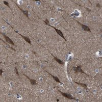 Anti-PAK5 antibody produced in rabbit 