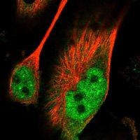 Anti-PAK5 antibody produced in rabbit 