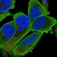 Anti-PALMD antibody produced in rabbit 