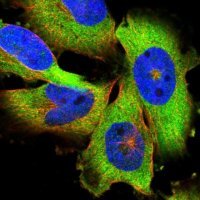 Anti-PAPD4 antibody produced in rabbit HPA054468-100UL