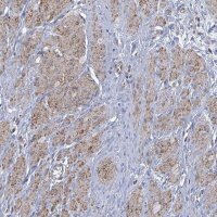 Anti-PAPSS1 antibody produced in rabbit 