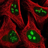 Anti-PAPSS1 antibody produced in rabbit 