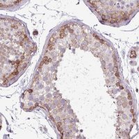 Anti-PARD6A antibody produced in rabbit 