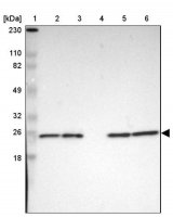 Anti-PARK7 antibody produced in rabbit 