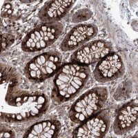 Anti-PARM1 antibody produced in rabbit 