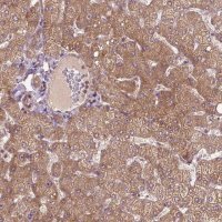 Anti-PARP3 antibody produced in rabbit