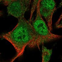 Anti-PARP9 antibody produced in rabbit 