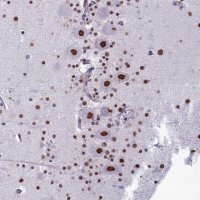 Anti-PARPBP antibody produced in rabbit 
