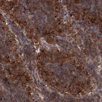 Anti-PATL1 antibody produced in rabbit 