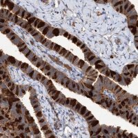 Anti-PATL1 antibody produced in rabbit 
