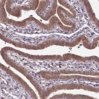 Anti-PCBP2 antibody produced in rabbit 