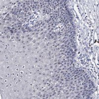 Anti-PCGF5 antibody produced in rabbit 
