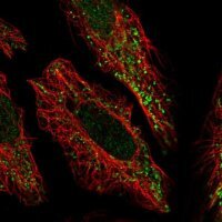 Anti-PCMTD2 antibody produced in rabbit 
