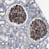Anti-PCOLCE2 antibody produced in rabbit 