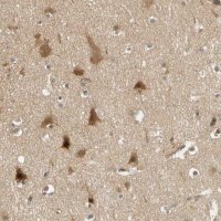 Anti-PDDC1 antibody produced in rabbit 