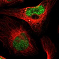 Anti-PDDC1 antibody produced in rabbit 