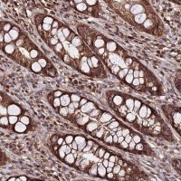 Anti-PDE4D antibody produced in rabbit