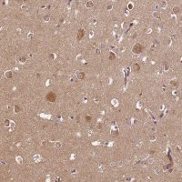 Anti-PDE6D antibody produced in rabbit 