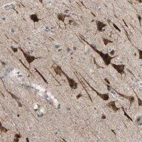 Anti-PDE8A antibody produced in rabbit