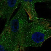 Anti-PDGFRB antibody produced in rabbit