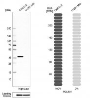 Anti-PDLIM1 antibody produced in rabbit HPA017010-100UL