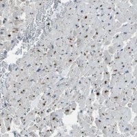 Anti-PDLIM1 antibody produced in rabbit HPA017010-100UL