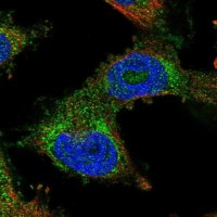 Anti-PDSS2 antibody produced in rabbit 