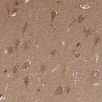 Anti-PDXP antibody produced in rabbit