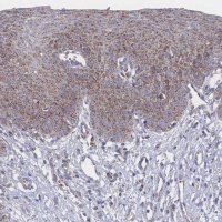 Anti-PEX14 antibody produced in rabbit 