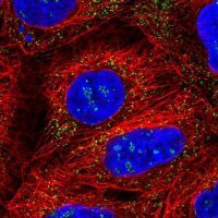 Anti-PEX14 antibody produced in rabbit 