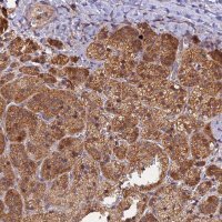 Anti-PEX3 antibody produced in rabbit 