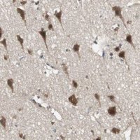 Anti-PFDN1 antibody produced in rabbit